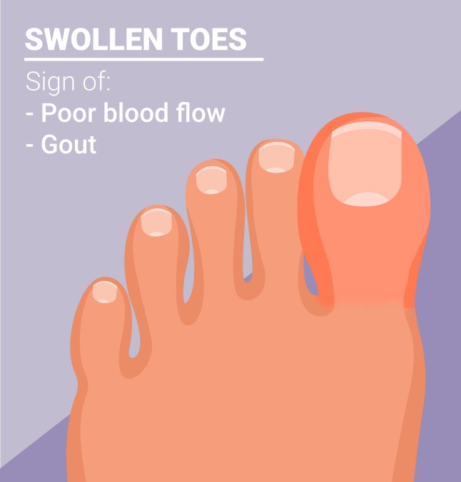 What your toenails say about your health