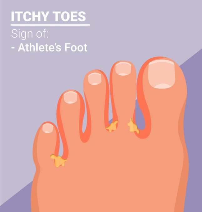 What your toenails say about your health