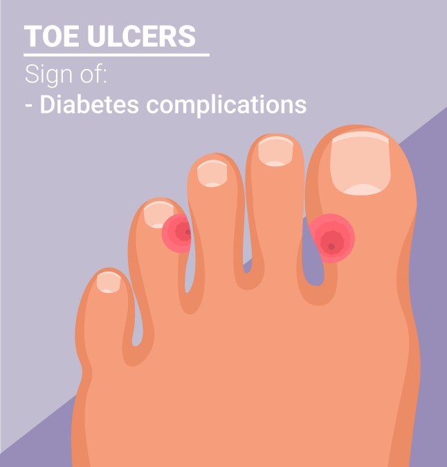 What your toenails say about your health