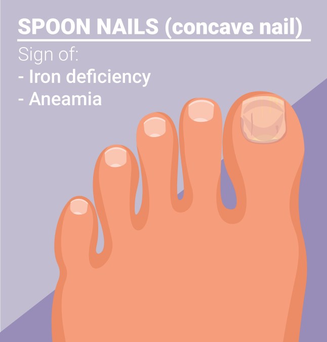 What your toenails say about your health