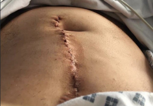 Kevin Tingley: I was stabbed multiple times