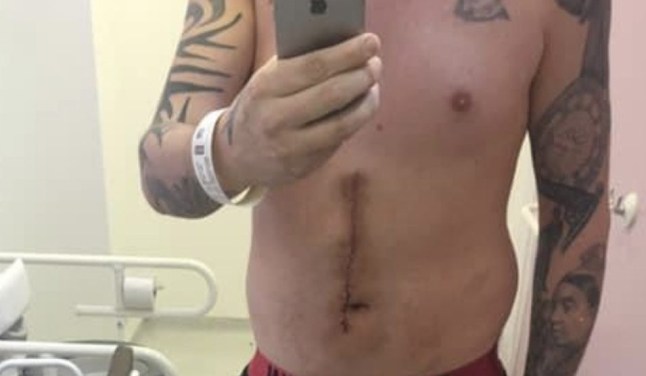 Kevin Tingley: I was stabbed multiple times
