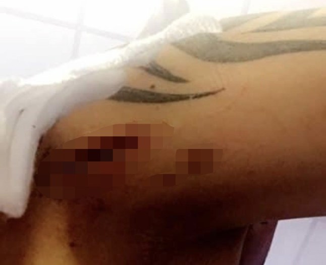 Kevin Tingley: I was stabbed multiple times