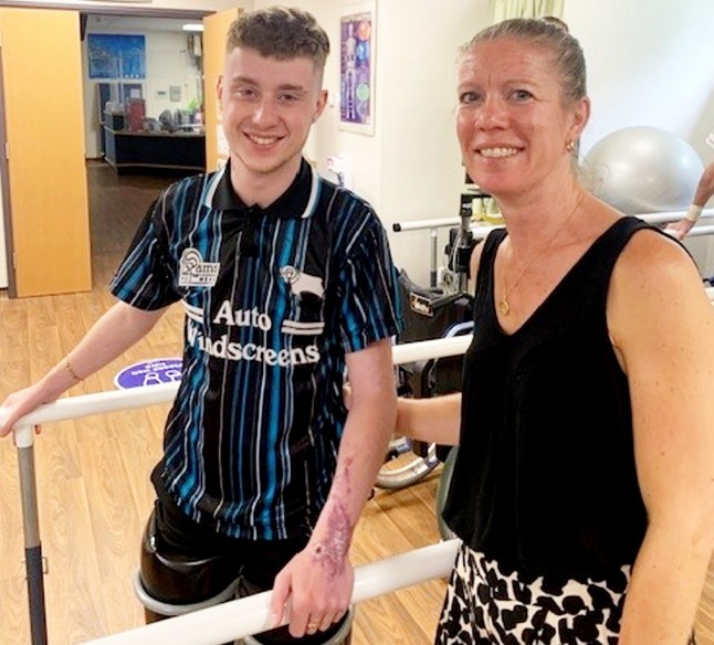 Levi Dewy had to have both of his legs amputated due to sepsis. A "fit and healthy" young man was forced to have both of his legs amputated just days before his 21st birthday - after his flu-like symptoms turned out to be sepsis. Levi Dewy was left in an induced coma with just a 30 per cent chance of survival after being struck down with the life-threatening condition. The previously active 20-year-old, who loved playing football, first fell sick with flu-like symptoms and began taking over-the-counter medications. But mum Lara took him to hospital after "mothers intuition" told her something was wrong when his condition failed to improve. The former JCB welder then went into sceptic shock and suffered multiple organ failure at Royal Derby Hospital. Medics found he was suffering from pneumococcal pneumonia and sepsis and he was transferred to Leicester's Glenfield Hospital for specialist treatment. Doctors told Lara and dad Neil their son would need surgery to amputate both legs below the knee - an operation he had two days before his 21st birthday. When he woke up Levi said he felt lucky to be alive but 'nothing could prepare him for how much his life would change.' Photo released 06/10/2025