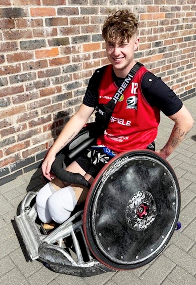 Levi Dewy had to have both of his legs amputated due to sepsis. A "fit and healthy" young man was forced to have both of his legs amputated just days before his 21st birthday - after his flu-like symptoms turned out to be sepsis. Levi Dewy was left in an induced coma with just a 30 per cent chance of survival after being struck down with the life-threatening condition. The previously active 20-year-old, who loved playing football, first fell sick with flu-like symptoms and began taking over-the-counter medications. But mum Lara took him to hospital after "mothers intuition" told her something was wrong when his condition failed to improve. The former JCB welder then went into sceptic shock and suffered multiple organ failure at Royal Derby Hospital. Medics found he was suffering from pneumococcal pneumonia and sepsis and he was transferred to Leicester's Glenfield Hospital for specialist treatment. Doctors told Lara and dad Neil their son would need surgery to amputate both legs below the knee - an operation he had two days before his 21st birthday. When he woke up Levi said he felt lucky to be alive but 'nothing could prepare him for how much his life would change.' Photo released 06/10/2025