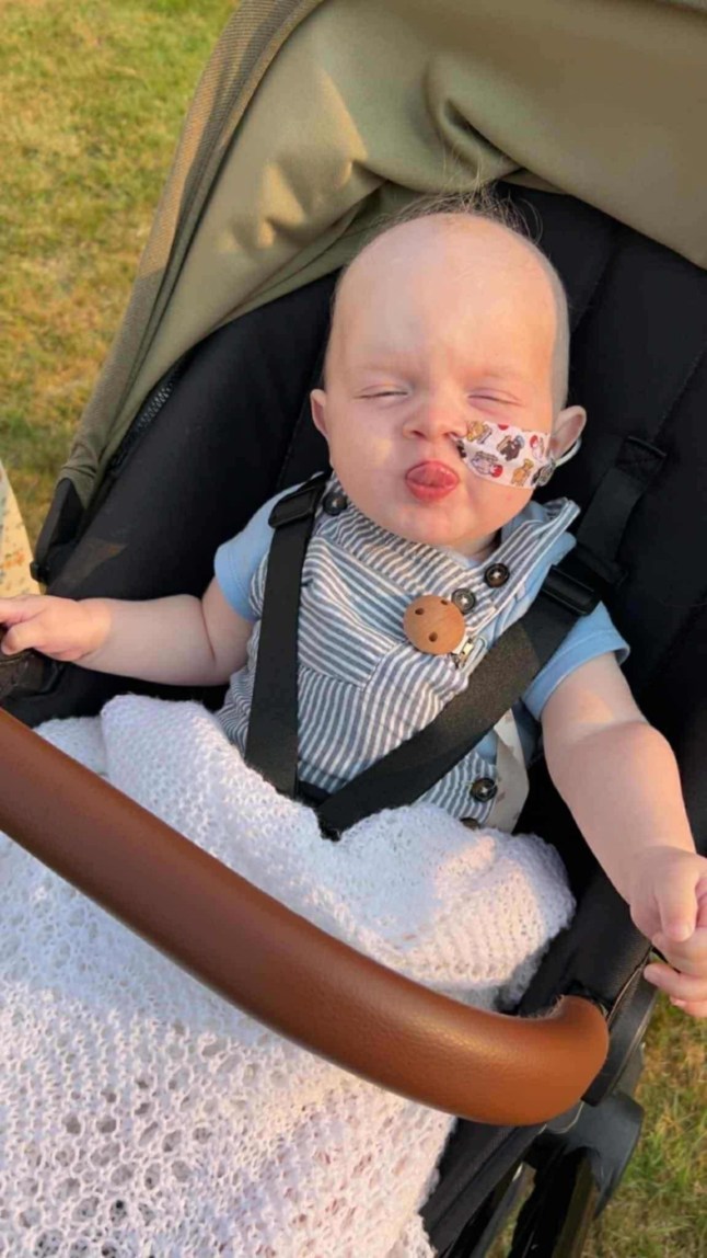 Baby Otto Acreman. // A one-year-old baby was diagnosed with a rare form of cancer after doctors initially thought his breathing problems were a cold. Otto Acreman's smitten parents are living a 'nightmare' after a spot at a family barbecue led to the devastating stage four diagnosis. Mum Sophie Reddaway, 25, and dad Paul Acreman, 27, were over the moon when they welcomed their first child was born in September 2024. Weighing seven lbs and three ounces, 'beautiful' Otto's birth was 'the best time' in the couple from Okehampton, Devon's lives. Photo released 29/10/2025