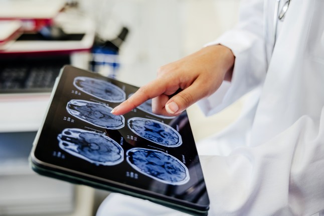 Close-up Shot of a Doctor's Hand Pointing on Brain Scan Images  on Digital Tablet