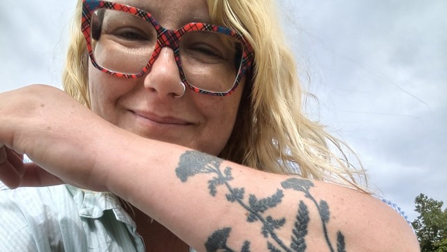 WORDS BYLINE: Deborah Cicurel Sepsis is a life-threatening condition that is terrifying to suffer from even once but Amani has had sepsis six times in five years. Amani, 37, from Bristol, has repeatedly had to deal with the condition, which at certain points has left her hours from death. Amani???s experience with chronic illness began in her twenties, in 2011, when she was a water sports instructor. A back injury while teaching coasteering, which involved sea swimming and cliff jumping, led to her suffering with permanent neurogenic bladder. This a condition where the nerves that control the bladder are damaged, which resulted in her not being able to pee. Since 2016, she has constantly had to use catheters, which is what has caused her sepsis each time. When Amani first got sepsis in 2020, she was intermittently self-catheterising up to 30 times a day, due to her bladder condition, which greatly increased the risk of contracting a urinary tract infection. ???In February 2020, I woke up one morning with what felt like a really badly sprained back,??? Amani remembers. ???I thought I???d somehow pulled a muscle, but I also felt quite delirious and unusually unwell. I took my temperature and I had a 40??? temperature. ???Unfortunately, when you live with severe chronic illness, you are used to living with such extreme and completely debilitating symptoms every day, so I pushed through my intense and scary symptoms for a couple of days. ???I remember feeling like something really bad was about to happen - an impending sense of doom - which I later learnt was actually a symptom of sepsis, and has been a symptom of it every time I have had sepsis since.??? After two days of being seriously unwell, Amani eventually called 111 at 4am, who immediately sent an ambulance to her flat. ???Due to my decades of medical trauma and fear of ???making a fuss???, I tried to refuse the ambulance and said that I would just get a friend to take me to the GP in the morning,??? Amani recalls. ???Luckily 111 refused my request to deny the ambulance, and sent one straight away. ???When I was then taken into Resus at the nearest hospital, they told me if I had actually denied the ambulance, I would have died in my sleep. ???I was only 2 hours away from dying when I got to them.??? Amani was treated with IV antibiotics, fluids, and pain relief. She was also given a lot of IV fluid to help her kidneys function properly again, but unfortunately her lungs took on fluid and she became really unwell from that, too. ???I don???t remember much of the hours and days that followed, because I was so unwell,??? Amani says. ???Eventually, after a few weeks of being in hospital, I was discharged home. ???Every time I have had sepsis, the transition of being discharged home from hospital is really hard, especially when you live alone. ???When you have nearly died again and been through so much medical trauma, adjusting back to ???normal life??? - whilst still very unwell and recovering - is really difficult. Not only physically, but also mentally.??? Amani has since learned that approximately 30% of all sepsis cases are due to urosepsis, a life-threatening medical emergency where an infection of the urinary tract spreads to the bloodstream. ???It has always been urosepsis that I have had, which is sepsis from UTIs, due to me requiring catheters,??? says Amani. ???The risk is greatly heightened if you have a catheter, or self-catheterise. ???But, despite all this, I had never been told about it, or what to look out for, despite being a catheter user and being immunocompromised. ???That is why I am so passionate about raising awareness about sepsis, specifically urosepsis, because it is so dangerous and can develop so dangerously quicker, and it is not talked about enough.??? Amani suffers with Post-Sepsis Syndrome (PSS) which leaves her with ongoing physical, mental, cognitive, and emotional challenges, following bouts of sepsis. 40% of people who have had sepsis live with PSS, which is a combination of physical, psychological, and cognitive problems that can occur after recovering from sepsis, often lasting for months or years. ???From my experience of surviving sepsis, and that of the many people I have connected with that have also survived sepsis, it can leave a lot to process in its wake and after you have survived it,??? she adds. ???Once you are home, and ???normal life??? continues around you, yet you nearly died and have so many emotions to process, it can feel incredibly isolating. ???Many people who have survived sepsis do not realise that it is common to experience symptoms following surviving sepsis - in both our mental health and physical health - so, raising awareness of post sepsis syndrome is really important, because it helps reduce isolation for post sepsis survivors and helps us better understand the impact of sepsis on survivors.??? An extra challenge for Amani is that despite being a repeat sufferer of sepsis, she often has to deal with the symptoms presenting differently. ???Throughout the six times of having sepsis, my symptoms have slightly varied, and not always followed the same pattern,??? she says. ???This is important, because sepsis can be so sneaky and can develop so quickly - for example my fourth time of having sepsis, in 2024, I had been admitted to hospital for a kidney infection. ???When I arrived, I was only mildly unwell, so they kept me in the corridor for observation and to await treatment, but within an hour I developed a 40??? temperature and started vomiting, and passing out. I had suddenly become seriously unwell, and was rushed through to receive IV antibiotics, with sepsis again.??? Amani???s sepsis symptoms have always varied slightly, but they have included a high or low temperature, vomiting and severe nausea, confusion and feeling delirious, an impending sense of doom, chills and shivering, feeling very systemically unwell, shaking uncontrollably, shortness of breath or breathing faster than usual, a rapid heart rate; feeling exhausted and sleeping too much or being unable to rouse properly. Amani is passionate about raising awareness of sepsis, which can often go undetected until it is too late. ???One in five deaths worldwide are due to sepsis, yet so many people don???t know what it is,??? she adds. ???It is also really important to remember that sepsis does not discriminate - even if you are not at a higher risk of sepsis like I am, anybody can get sepsis, so it is essential to know the signs and symptoms. It can literally save a life. ???Sepsis is often not known about enough, and causes so many deaths that could potentially be avoided if there was more awareness. ???As someone who was immunocompromised and self-catheterising and prone to infections, I was at risk of sepsis risk, yet I had no idea what urosepsis even was until I first nearly died from it in 2020.??? Amani works with sepsis charity Sepsis Research FEAT, helping raise awareness for the work and research they do. She wants to urge people to educate themselves about the symptoms of sepsis and always seek medical help immediately if they are concerned. ???My biggest advice to anyone wondering if they have sepsis is that you know your body better than anybody, so listen to how you feel, and trust your instincts, because it literally can save your life,??? says Amani. ???If you feel like something is wrong, seek immediate medical advice, because if I had tried to ???push through' any longer, when I first had sepsis, I would have died in my sleep.??? Featuring: Amani in nature in 2025 When: 03 Nov 2025 Credit: Cover Images **All usages and enquiries, please contact info@cover-images.com - +44 (0)20 3397 3000EDITORIAL USE ONLY. MATERIALS ONLY TO BE USED IN CONJUNCTION WITH EDITORIAL STORY. THE USE OF THESE MATERIALS FOR ADVERTISING, MARKETING OR ANY OTHER COMMERCIAL PURPOSE IS STRICTLY PROHIBITED. MATERIAL COPYRIGHT REMAINS WITH STATED PHOTOGRAPHER AND/OR SUPPLIER.**