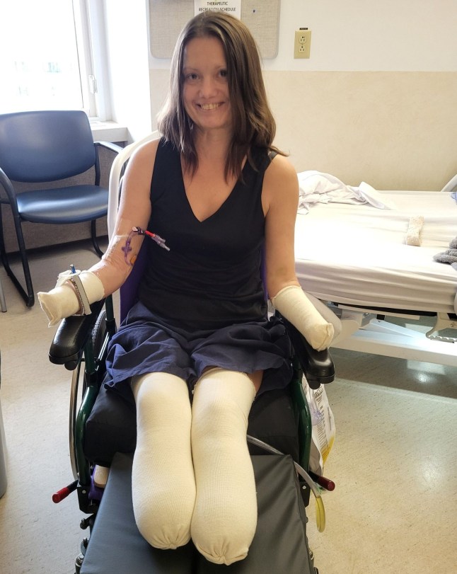 Pic from Kennedy News & Media (Pictured: JANE HALEY, 41, IN HOSPITAL, AFTER HAVING HER FOUR LIMBS AMPUTATED.) A sports-mad woman was left a quadruple amputee after swollen glands from 'an infection' turned out to be deadly septic toxic shock syndrome. Jane Haley, from Alberta in Canada, suffered from strep throat in June 2025 but after taking a course of antibiotics said she was back to her normal self. When she began to develop a pain in her jaw, cheek and the left side of her neck in August, she assumed it was an infection and called a medical advice health line. DISCLAIMER: While Kennedy News and Media uses its best endeavours to establish the copyright and authenticity of all pictures supplied, it accepts no liability for any damage, loss or legal action caused by the use of images supplied and the publication of images is solely at your discretion. SEE KENNEDY NEWS COPY - 0161 697 4266