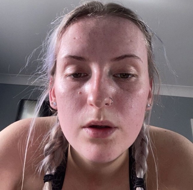 PIC FROM Kennedy News and Media (PIC SHOWS: DARCIE HAMILTON, 22, SUFFERS FROM THE RARE SWEATING CONDITION HYPERHIDROSIS) A woman with 'one of the worst cases' of sweating doctors have ever seen says the rare condition left her perspiring THREE LITRES of sweat a day. Darcie Hamilton, who lives near Ayr, Scotland, noticed she was sweating more than her peers at 10 years old during primary school. But as she grew older, Darcie's issue worsened, forcing her to take desperate measures to hide her problem from classmates. DISCLAIMER: While Kennedy News and Media uses its best endeavours to establish the copyright and authenticity of all pictures supplied, it accepts no liability for any damage, loss or legal action caused by the use of images supplied and the publication of images is solely at your discretion. SEE KENNEDY NEWS COPY - 0161 697 4266