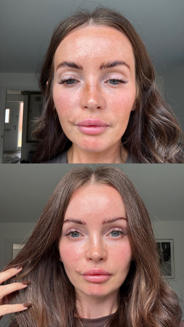 Before and after pics of a person using the Renew + Me Nightly-Active-Treatment