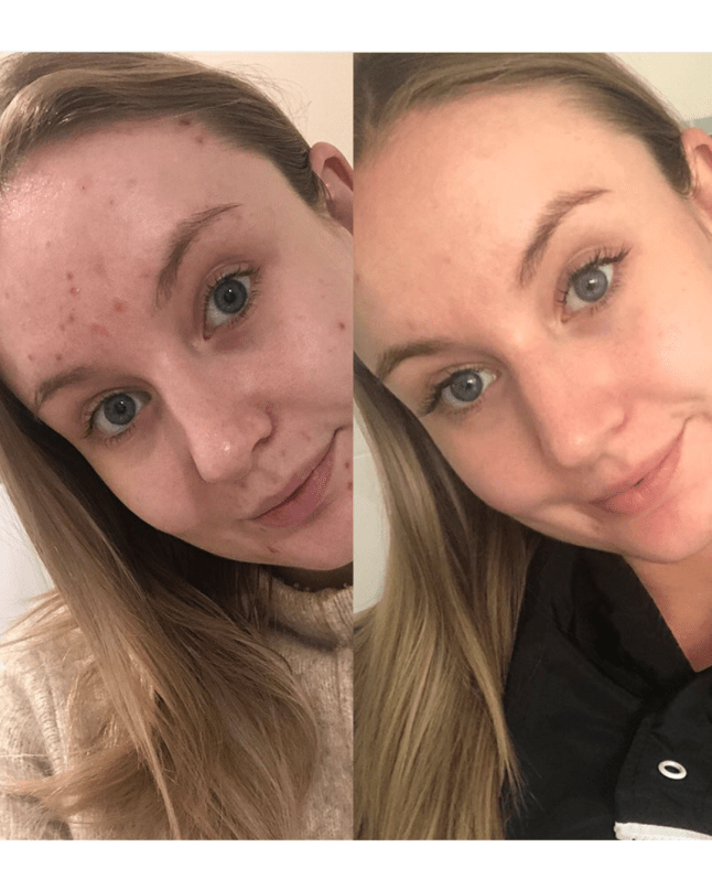 Before and after image of female face