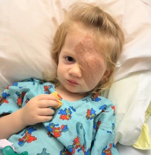PIC FROM Kennedy News and Media (PICTURED: MILEY DRAIME, 2, AFTER GETTING EYE REMOVED) A mum claims a baby monitor saved her tot's life after it revealed a 'glow' in her pupil - that turned out to be cancer. Kristen Draime was concerned about her daughter Miley Draime when she noticed her left eye 'wandering' in September 2025 and booked an appointment with a doctor. Initially reassured it wasn't anything to worry about, the paediatrician referred Miley for a December appointment with an ophthalmologist to rule out anything more serious. DISCLAIMER: While Kennedy News and Media uses its best endeavours to establish the copyright and authenticity of all pictures supplied, it accepts no liability for any damage, loss or legal action caused by the use of images supplied and the publication of images is solely at your discretion. SEE KENNEDY NEWS COPY - 0161 697 4266