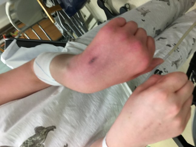 Amy Pohl - I was diagnosed with the 'suicide disease' in my 20s - now, I wouldn?t change a thing