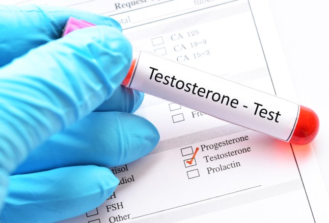 Testosterone hormone test