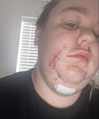 Katie McVeigh (Jade Beecroft) sunbed tanning mum