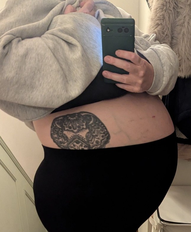 Becki Ward before having the 12kg tumour removed. A woman who thought she couldn?t lose weight on Mounjaro because she was ?lazy?, actually had a 12kg tumour growing inside her. Becki Ward, 33, decided to start weight loss jabs after struggling to shift the pounds naturally, but was confused as they didn?t seem to be working. After starting to get stomach pains and night sweats, the Trainee Education Mental Health Practitioner, from Great Yarmouth, Norfolk, went to the doctors, and after five months of tests was finally diagnosed with pseudomyxoma peritonei, an extremely rare form of mucinous cancer. Following the diagnosis, Becki?s stomach continued to grow so large it looked like she was having twins, and in August 2025, she had surgery to remove a 12kg tumour, as well as removing some of her organs, and having a full hysterectomy, plunging her into early menopause. Photo released 12/02/2026